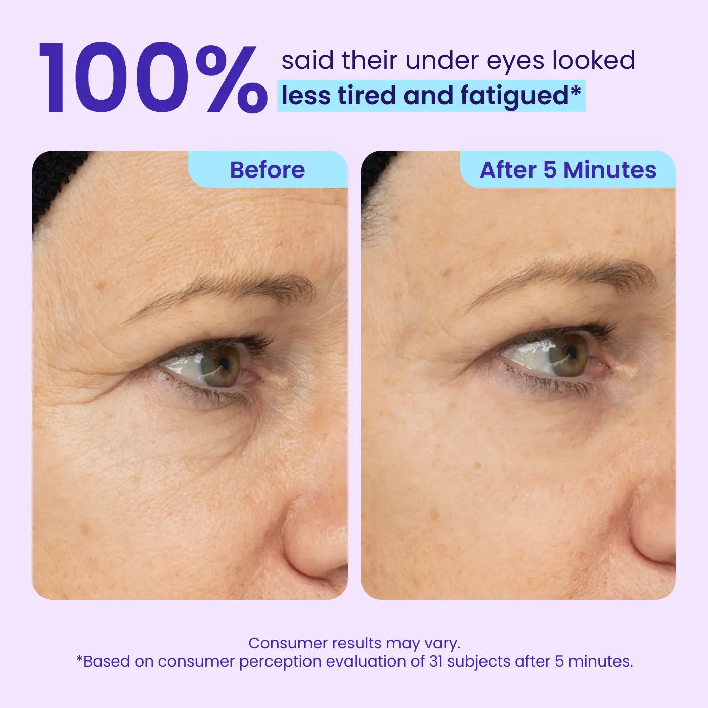 Eye Bag Instant Eraser