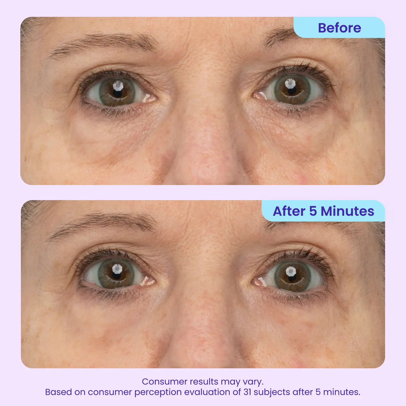 Eye Bag Instant Eraser